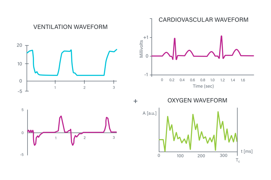 心血管、換気、酸素装置用の特定のトーンを示すさまざまな波形グラフ